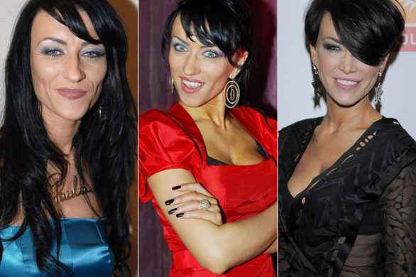 Oto najodważniejsza wypowiedź o opercjach plastycznych?