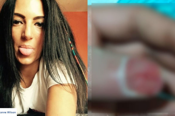 Ta kobieta prawie straciła palec! Wszystko przez paznokcie akrylowe!