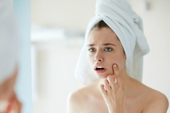 Jak poradzić sobie z pryszczem, gdy pojawia się w najmniej oczekiwanym momencie?