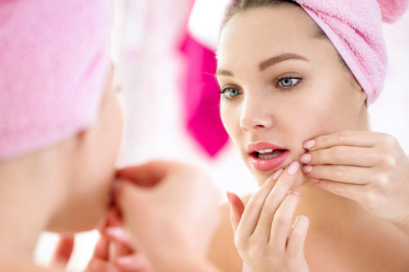 Zobacz, co możesz wyczytać z pryszczy! Ich umiejscowienie zdradza wiele!