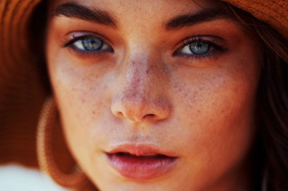 Jak wyciskać pryszcze bez powstawania blizn?