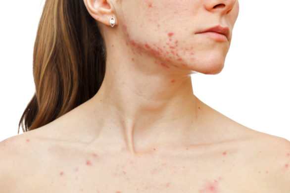 Zdjęcia „przed i po” tej kobiety wstrząsnęły Internetem! Zobaczcie dlaczego!