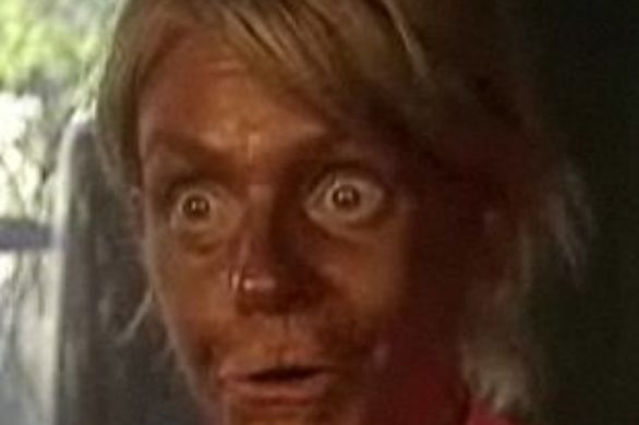 Matka poparzyła 5-latkę na solarium!