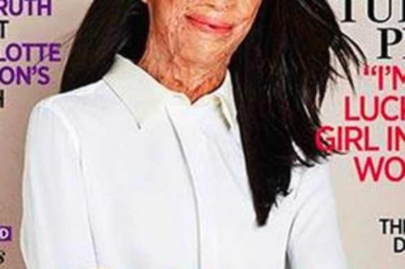 Ciężko poparzona Turia Pitt na okładce Women’s Weekly!