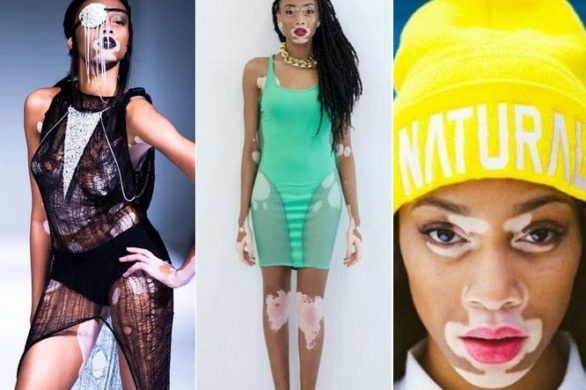 Winnie Harlow  – modelka z bielactwem (FOTO)