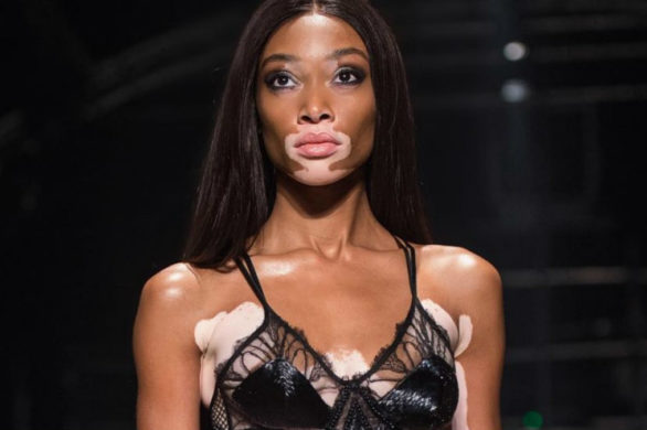 Winnie Harlow wściekła na tabloidy: wyglądam, jakbym cierpiała?!