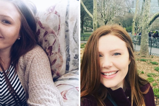 Ta kobieta zachorowała na raka! Wszystko przez nieudaną wizytę u dermatologa