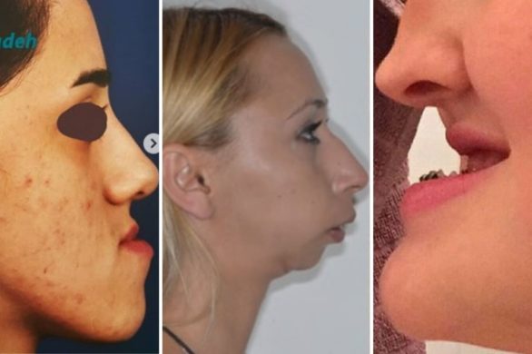 Chirurgia plastyczna to jednak sztuka. Lekarz wyrzeźbił ich twarze od nowa