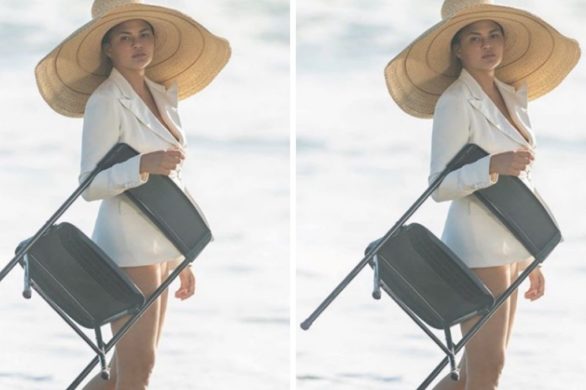 Chrissy Teigen — nie uwierzycie, gdzie wstrzyknęła botoks