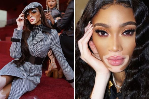 Winnie Harlow zdradza największy sekret modelek. Tak dbają o cerę