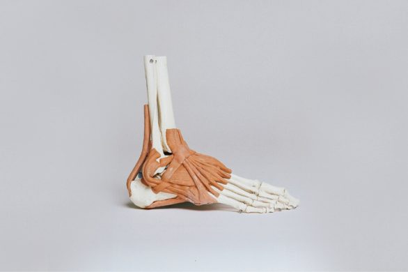 Z problemem palucha koślawego zmaga się nawet 1,5 mln Polaków (głównie kobiet). Ty też się na niego narażasz?