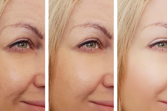 Stosujesz kremy z kolagenem? To może być zły wybór