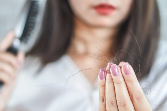 Usłyszałam diagnozę łysienie telogenowe. Jakie są przyczyny?