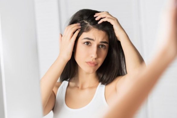 Problem z łupieżem? Te jogurtowe maseczki działają jak lekarstwo na skórę głowy