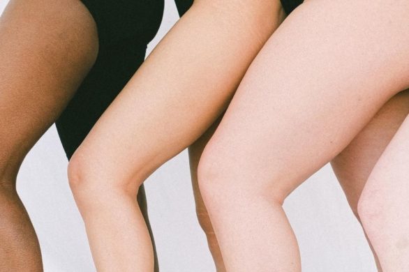 Wysypka i czerwone kropki po depilacji: sposoby na podrażnienia po depilacji, które przynoszą natychmiastową ulgę