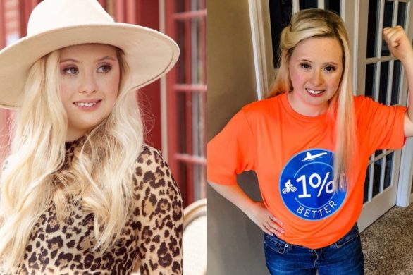 24-letnia modelka z zespołem Downa została ambasadorką marki kosmetycznej