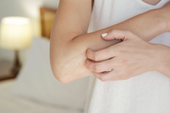 Zimą swędzi Cię całe ciało? Zobacz, co jest przyczyną i jak temu zapobiegać!