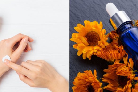 Fantastyczny, chociaż mało znany sposób na pękające naczynka i trądzik. Pokochasz go od razu!