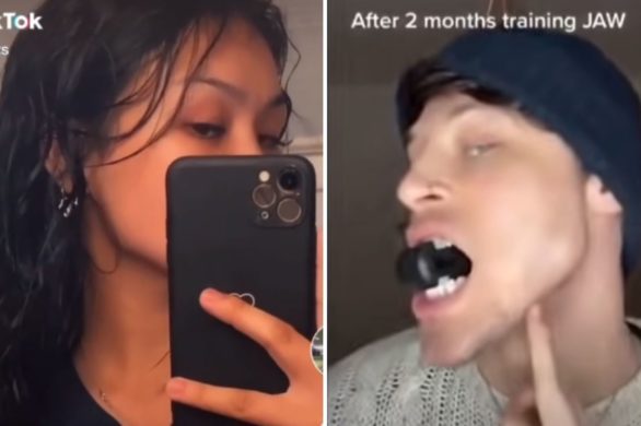 Jaw training to niebezpieczny trend z Tik Toka. Eksperci alarmują – to niszczy stawy