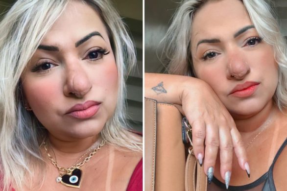 Internauci ciągle wypominają jej, że nie powinna pokazywać swojej twarzy. Na co dzień mierzy się z hejtem