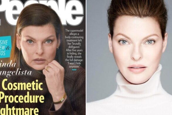 Linda Evangelista udostępnia pierwsze zdjęcia ciała od czasu nieudanego zabiegu kosmetycznego
