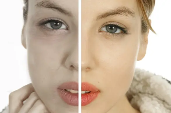 Oto 7 przykładów jak palenie papierosów niszczy Twoją skórę