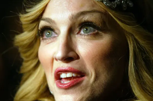 Internauci pytają, co stało się z twarzą Madonny. Odpowiedź jest jedna