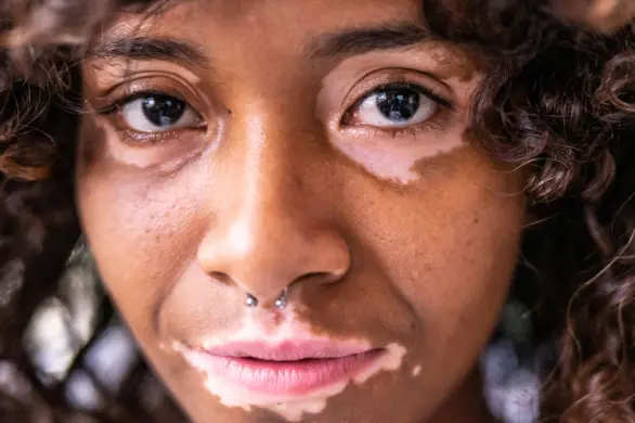 Najrzadsze cechy ciała, które posiada zaledwie garstka ludzi