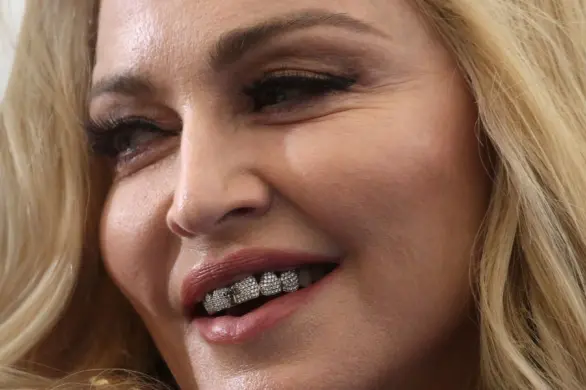 Madonna pokazuje twarz po zejściu „opuchlizny po operacji”