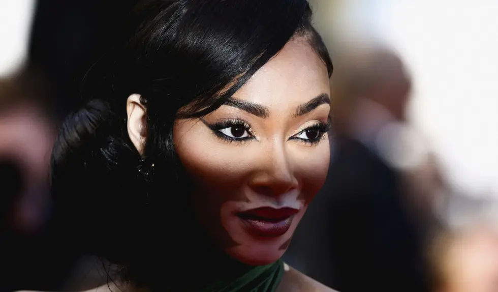 Winnie Harlow w sieci rybackiej – sukienka w stylu mermaidcore