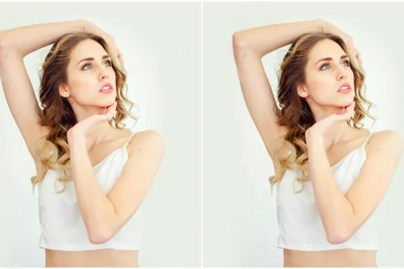 20-latki w gabinetach medycyny estetycznej. Czy to dobry trend?