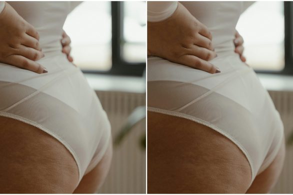 3 najlepsze akcesoria do zwalczania cellulitu, które naprawdę działają