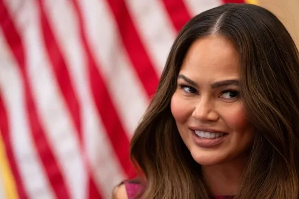 Chrissy Teigen przeszła operację obniżenia linii włosów. Powód zaskakuje