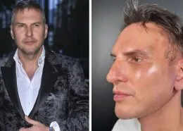 Krzysztof Gojdź przeszedł poważną operację. „Najlepiej spać na pół siedząco”
