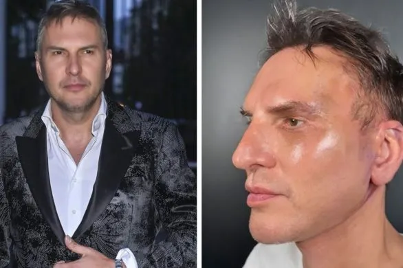 Krzysztof Gojdź przeszedł poważną operację. „Najlepiej spać na pół siedząco”