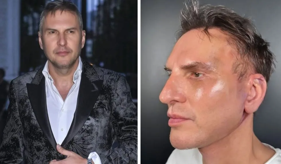 Krzysztof Gojdź przeszedł poważną operację. „Najlepiej spać na pół siedząco”