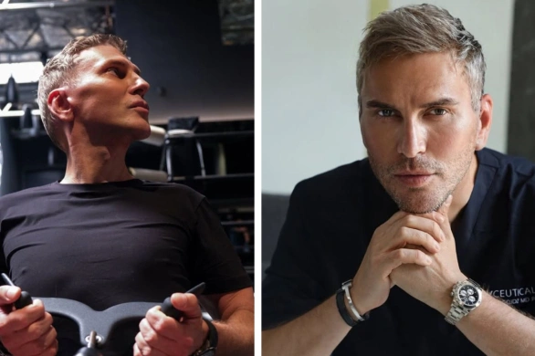 Gojdź prezentuje nową twarz miesiąc po zabiegu. Efekty są piorunujące!