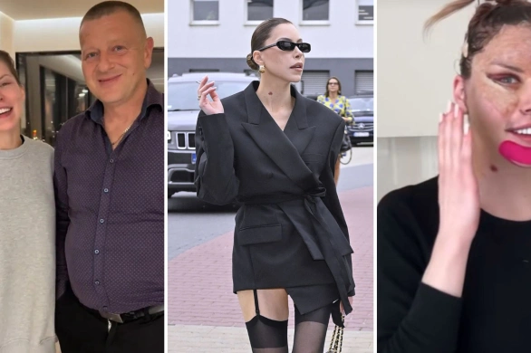 Internauci przerażeni nową twarzą Julii von Stein. „Coś Ty zrobiła?”