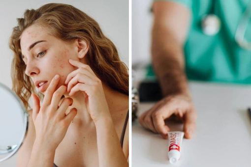 Kosztują grosze, a świetnie radzą sobie z wypryskami. Ten duet zawsze powinnaś mieć w swojej kosmetyczce