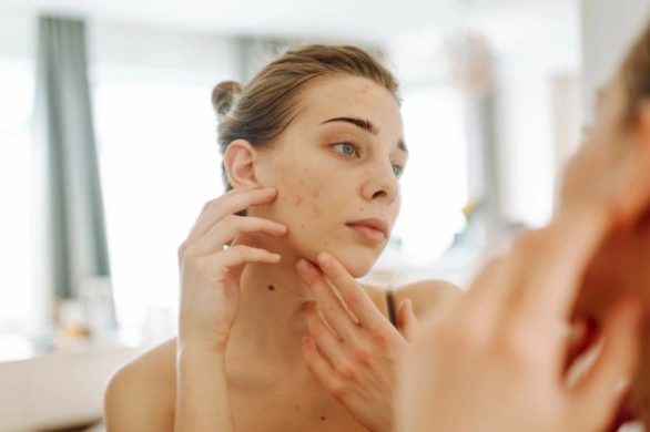 Polki pokochały te plastry na wypryski. „Jedne z lepszych na rynku”