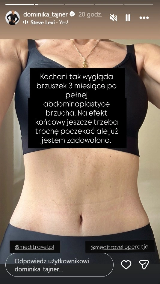 Dominika Tajner prezentuje brzuch po operacji