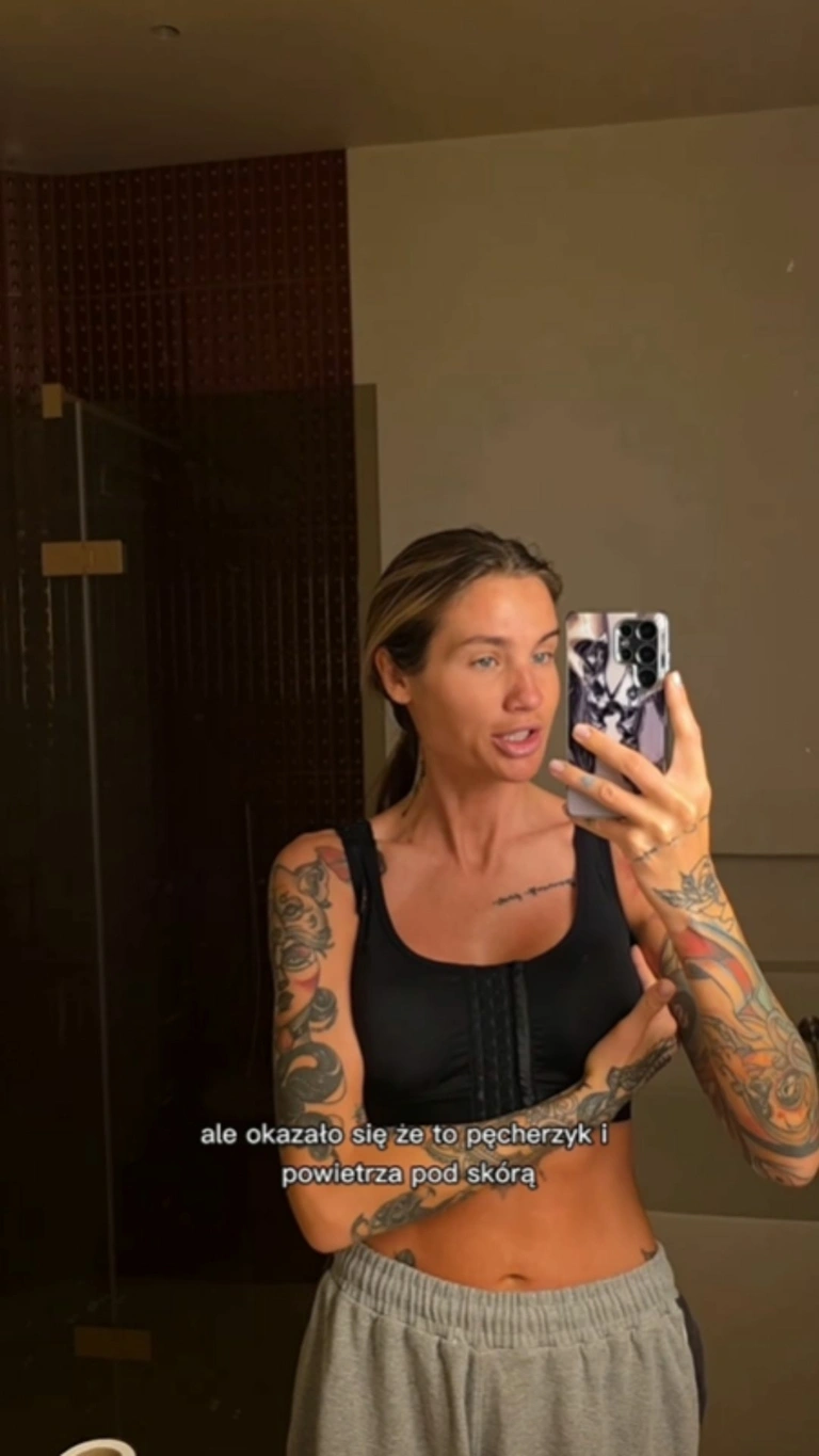 karolina-gilon-po-operacji