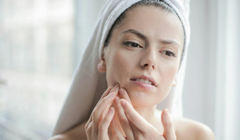 Najlepsze preparaty punktowe na wypryski. Przyspieszają gojenie zmian skórnych